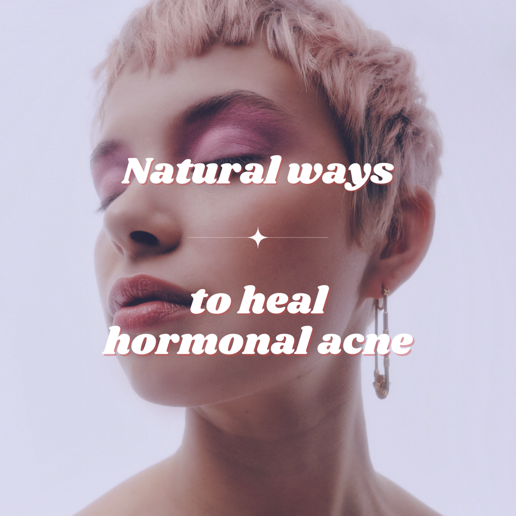 9 Natural ways to Heal Hormonal Acne